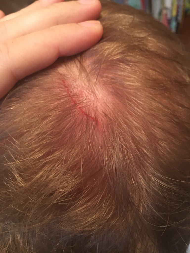 goody_scott's tweet photo. Attacked by a MississippiKite the other day at work. Must've been teaching its babies to hunt. #sharptalons https://t.co/tTZwn1e7VP