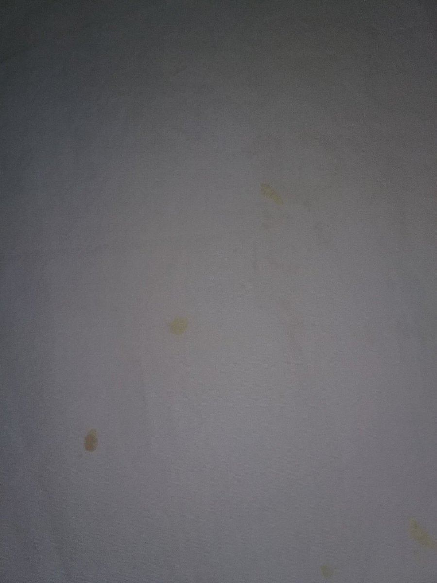 BenRodes's tweet photo. @Super8Hotels my sheets have yellow hardened goo &amp; cigarette burn holes, &amp; cockroaches are crawling around https://t.co/35LvaAWAwc