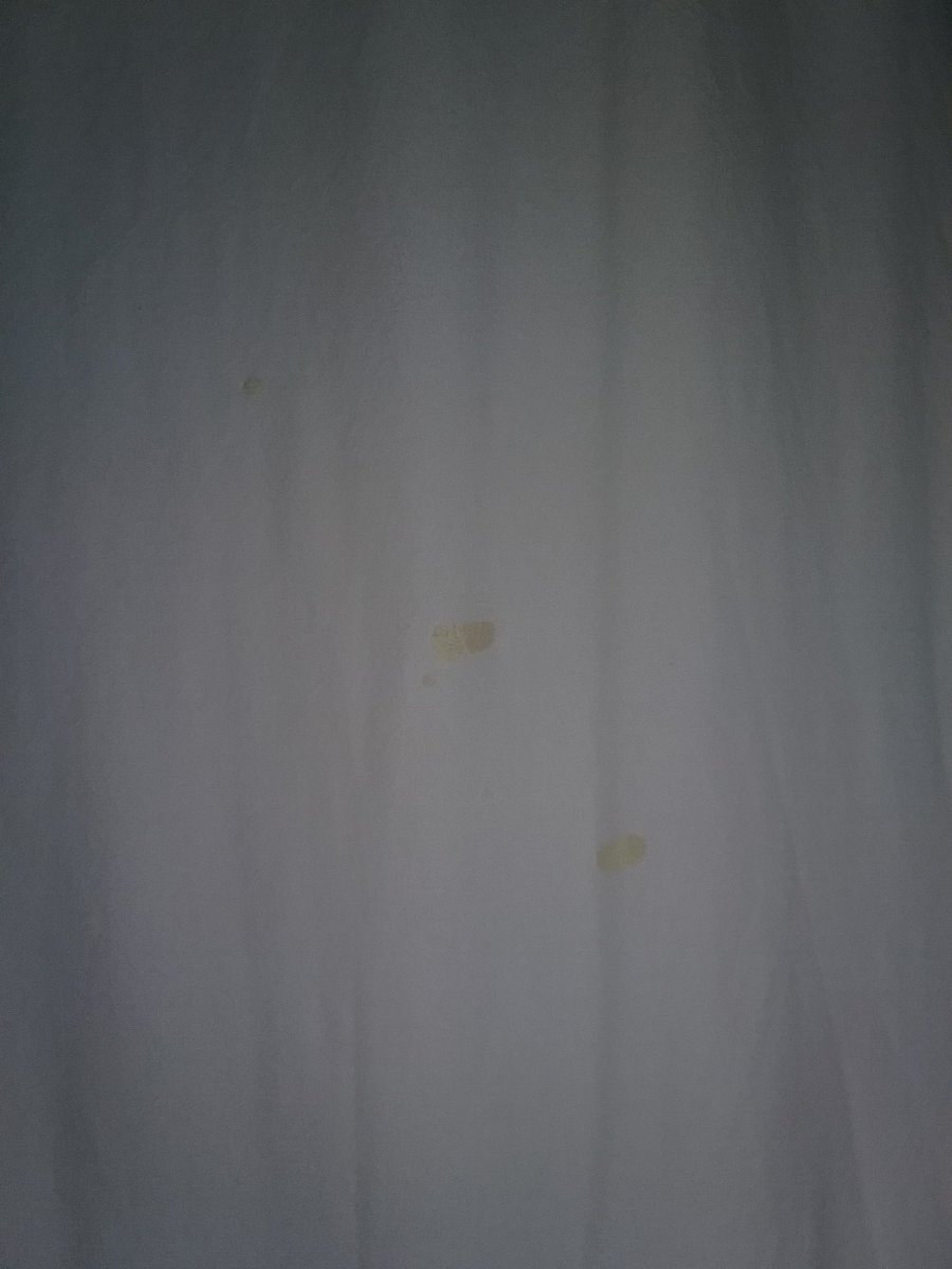 BenRodes's tweet photo. @Super8Hotels my sheets have yellow hardened goo &amp; cigarette burn holes, &amp; cockroaches are crawling around https://t.co/35LvaAWAwc