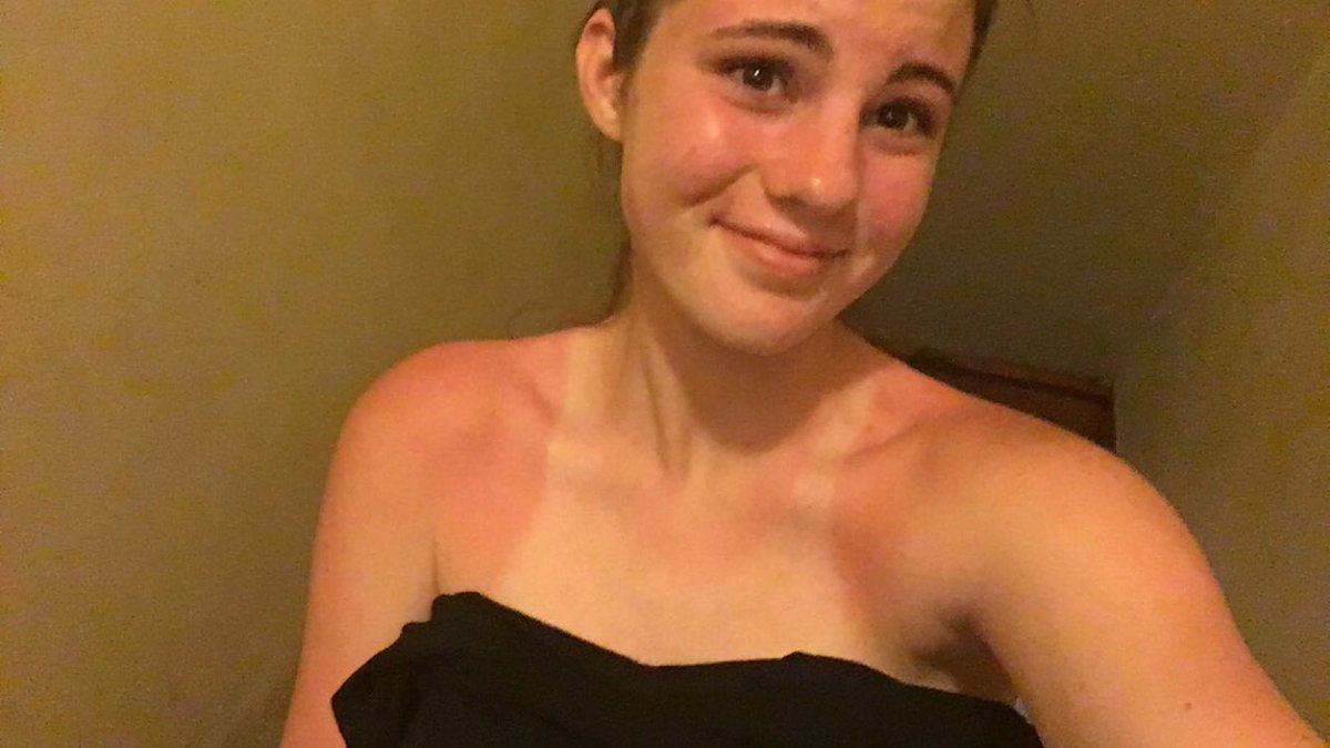 I've been praying that God would bless me with some color this summer... forgot to mention what color though.😫😭🍅