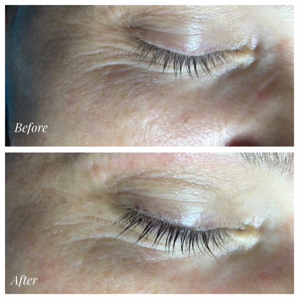 Skinsolution101's tweet photo. This is what a Facial &amp; an Eye Lash Tint can do for you! Less wrinkles AND deep black eye last tint!! Book yours https://t.co/BLGnnpSjaW