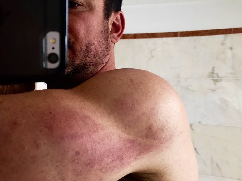SandyTep_'s tweet photo. Lessons to learn from @deancain 

Don't scrape an ice wall @ 60 mph. It seems painful. #TheJump2016 

Too soon? https://t.co/fEwWRC2Zwp