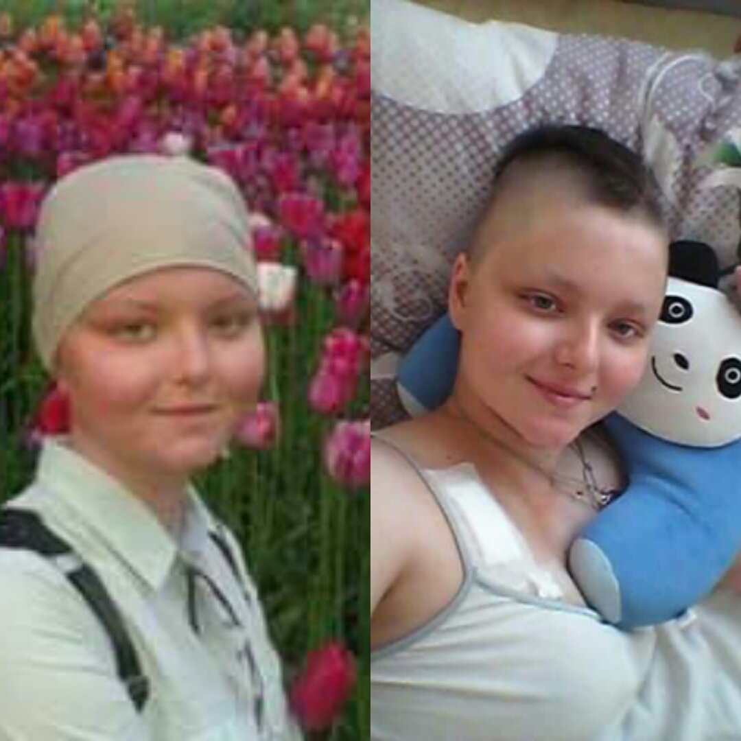 golife_go's tweet image. Потрібні донори для Третьякої Богдани! Група крові (І). На еромасу і на тромбоконцентрат.
Мама Наталія 0674967260