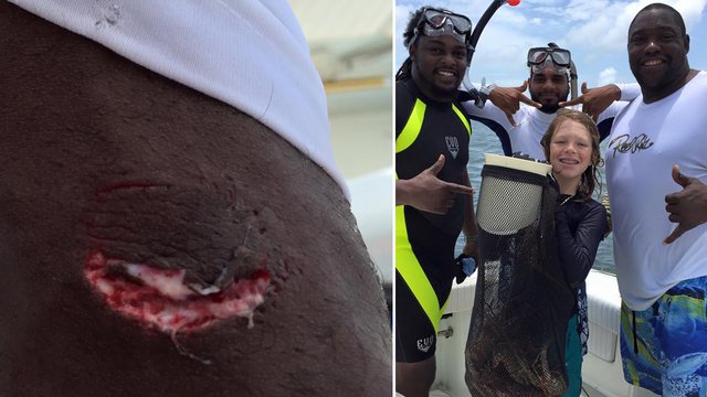 fox5dc's tweet photo. Warren Sapp bitten by shark while lobstering @WarrenSapp https://t.co/GBkmL0U3Fo https://t.co/RWLpCMxYdf