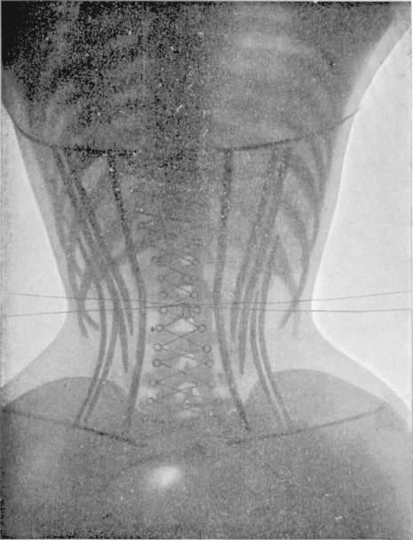 eTobbTweets's tweet photo. X rays of women in corsets in 1908. https://t.co/BckeReuhVd