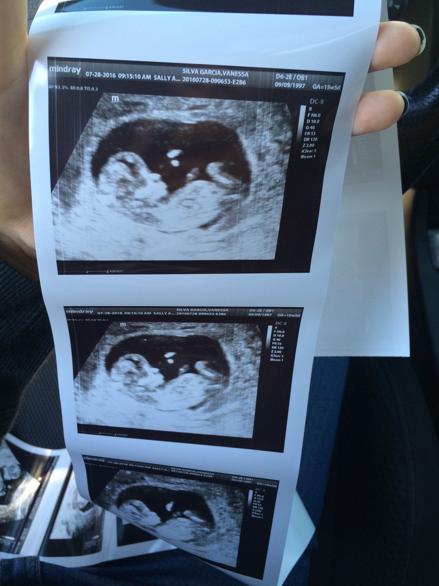 nesssa___'s tweet photo. saw this bundle of joy today!!!! Can't wait for you to be here! 💙💗 

@Dylanpottermma I love you! 😻😚 https://t.co/OmtbPf3Lho