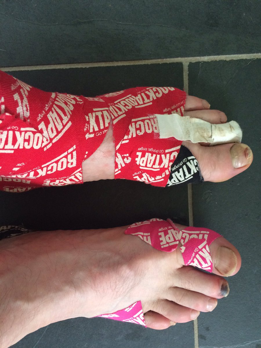 theclearhead's tweet photo. @RaceToTheStones #StonesSelfie https://t.co/iNOGjthANl