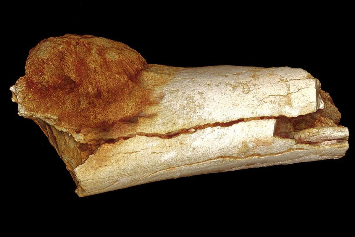 newscientist's tweet photo. Fossil tumour is oldest evidence of human cancer discovered yet https://t.co/lkE2UyGPL6 https://t.co/rT038Jb17a