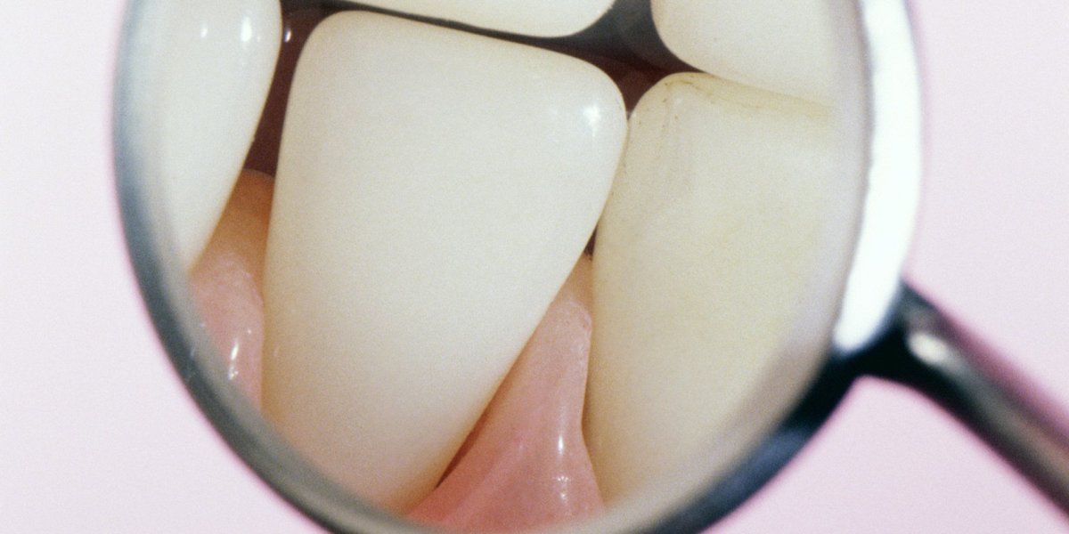 apexdocsolution's tweet image. Important information for those on birth control. huff.to/1lUcHvX #dentist