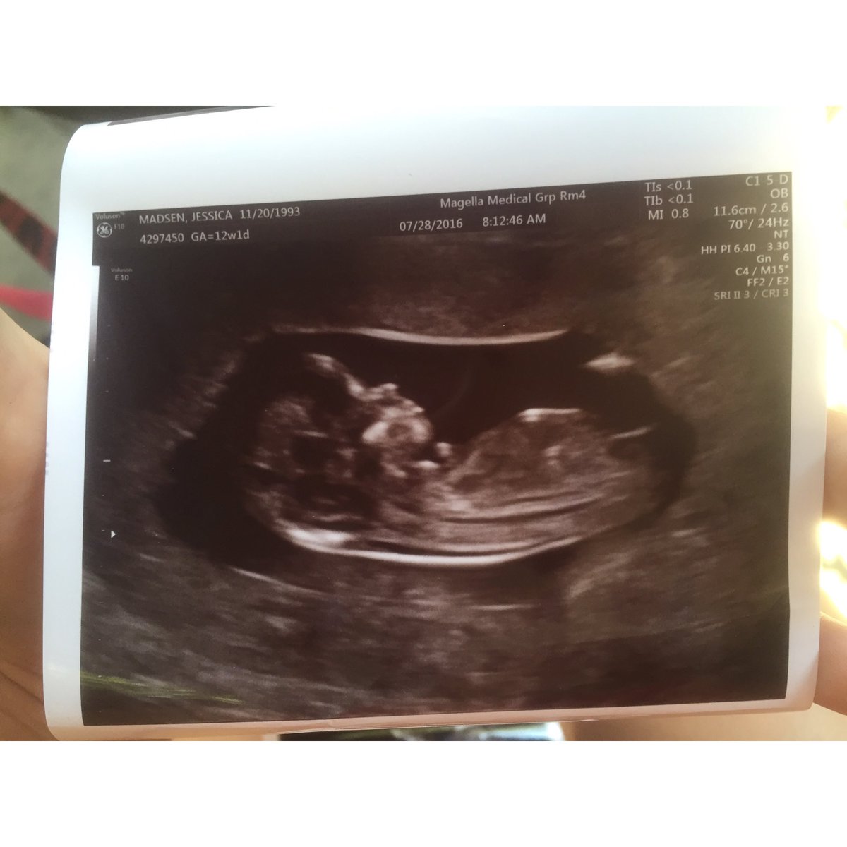 _princesssarrah's tweet photo. I'm gunna be an auntie😍😍
#HopingForAGirl👑🎀
#12Weeks💘 https://t.co/Ar7nPOM4Hm