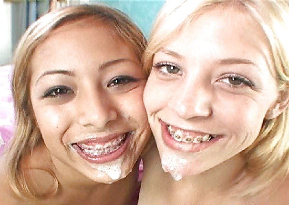 Teens With Braces Sex Videos 80