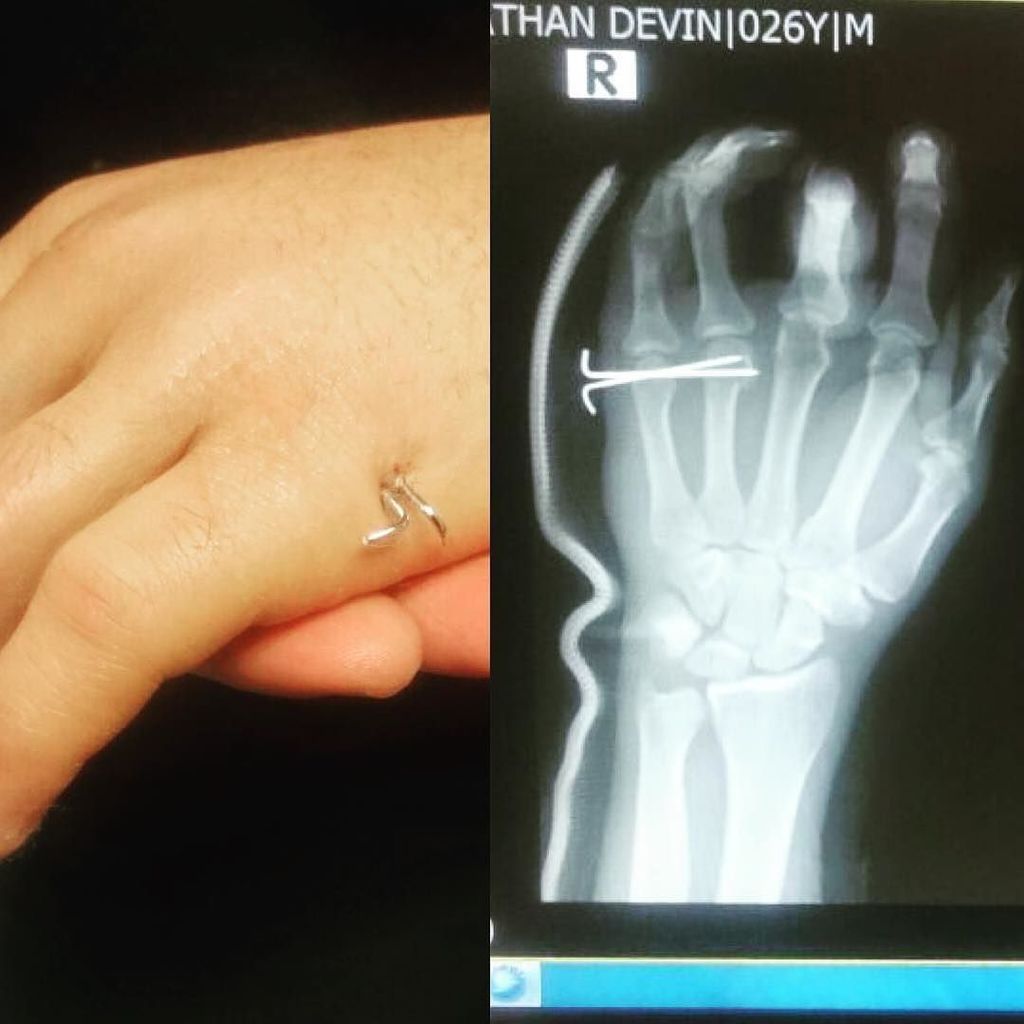 jonnybmc's tweet image. It literally went down to the wire. #3weekstogo #countyourblessings ift.tt/2aet0z1