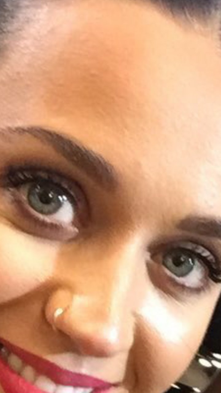 Katy Perry eye
