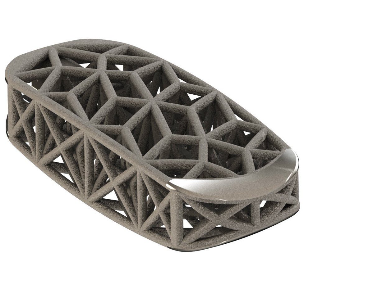 SpinalNewsInt's tweet photo. US FDA clears #4WEB Lateral Spine Truss system https://t.co/jgN6rkBJLW https://t.co/WFu28QIUXB