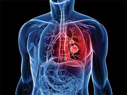 drpramojjindal.com/contact-dr-pra…

Contact Us 9818631324