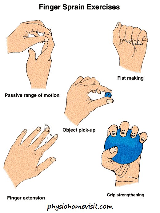 physiohomevisit's tweet image. Basic exercises for finger sprain ~ physiohomevisit.com
#physiohomevisit #fingersprain #physiotherapists #visit