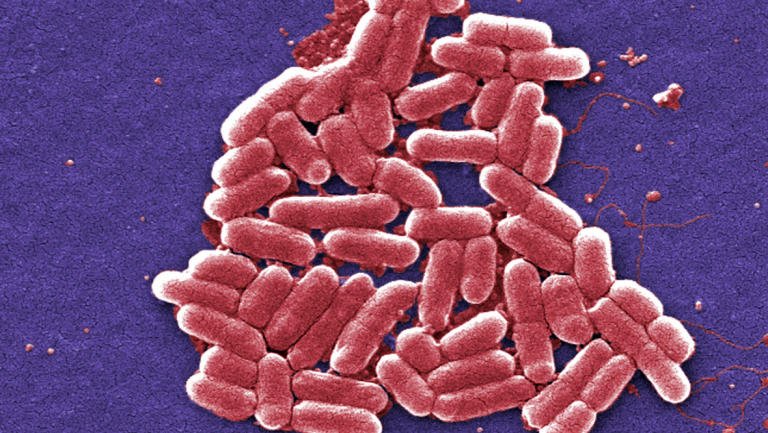 BearsdenFryer's tweet photo. Wasn't us.     “@STVNews: Sixteen fall ill in E.Coli outbreak linked to blue cheese
https://t.co/rroN8kKjEZ https://t.co/ljYxDh02qj”