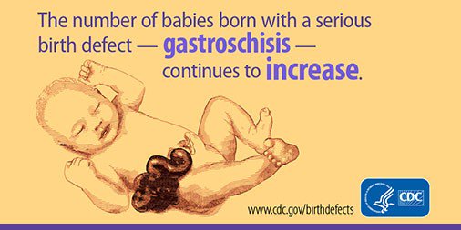 CDCgov's tweet photo. DYK the number of babies born w/ #gastroschisis continues to rise? CDC’s latest findings: https://t.co/bTze95e1gg. https://t.co/ITZwKYm97Z