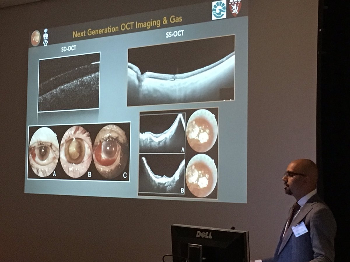Dr. Netan Choudhry lecturing on macular hole surgery to the next generation of Retina Surgeons at the #meei course