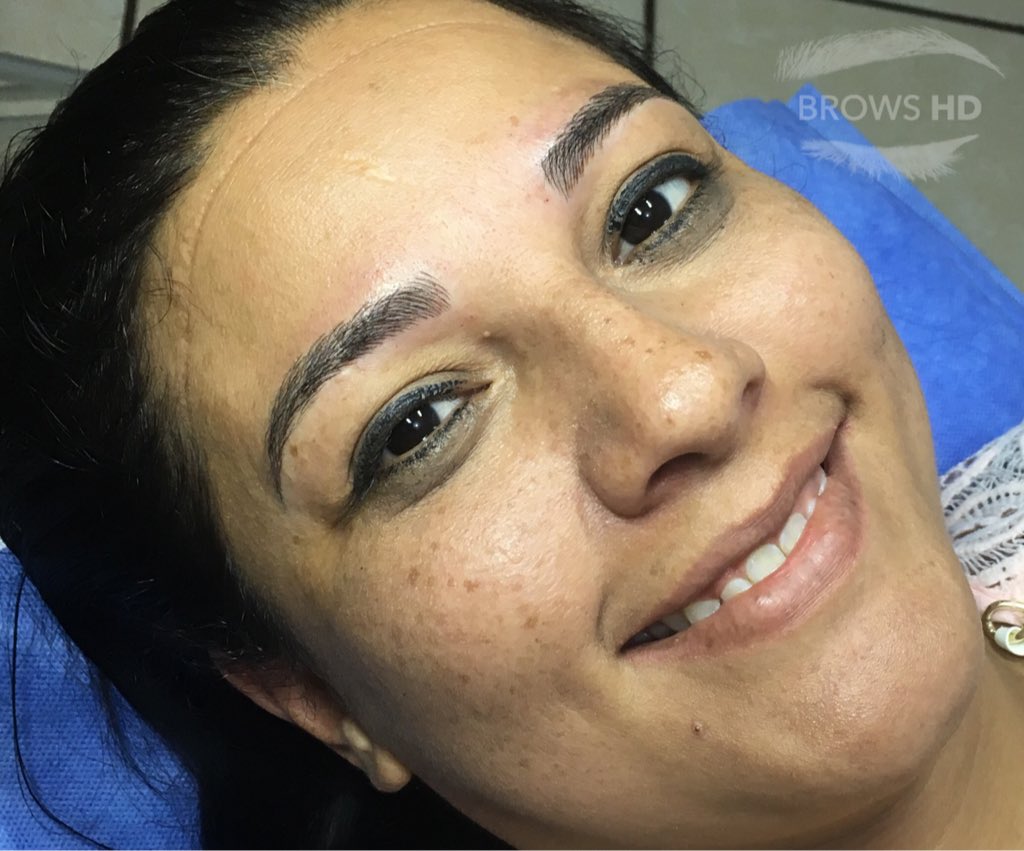 LaGrekaN's tweet photo. Cubrimos una cicatriz en la ceja de mi clienta. 
#Microblading #CejasHD #BrowsHD #EspecialistaEnCejas https://t.co/PunAQlNqvt