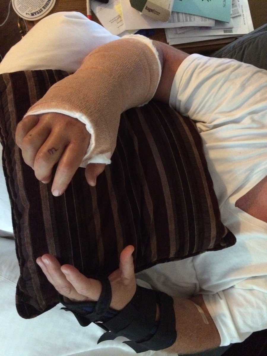 Robroc89's tweet photo. #papadukes#broken writs#SUCKS#has a bell and rings it when he needs something, I'm gona break it soon!!! https://t.co/YHX9ki8PLQ