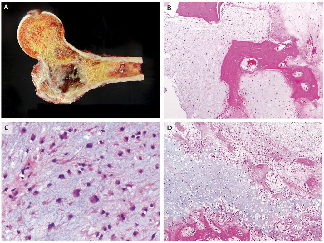 NEJM's tweet photo. Case Record of the #MGH: A 46-Year-Old Man with Somnolence after Orthopedic Surgery https://t.co/GaQOrexkj5 https://t.co/aS1LDLqnrk