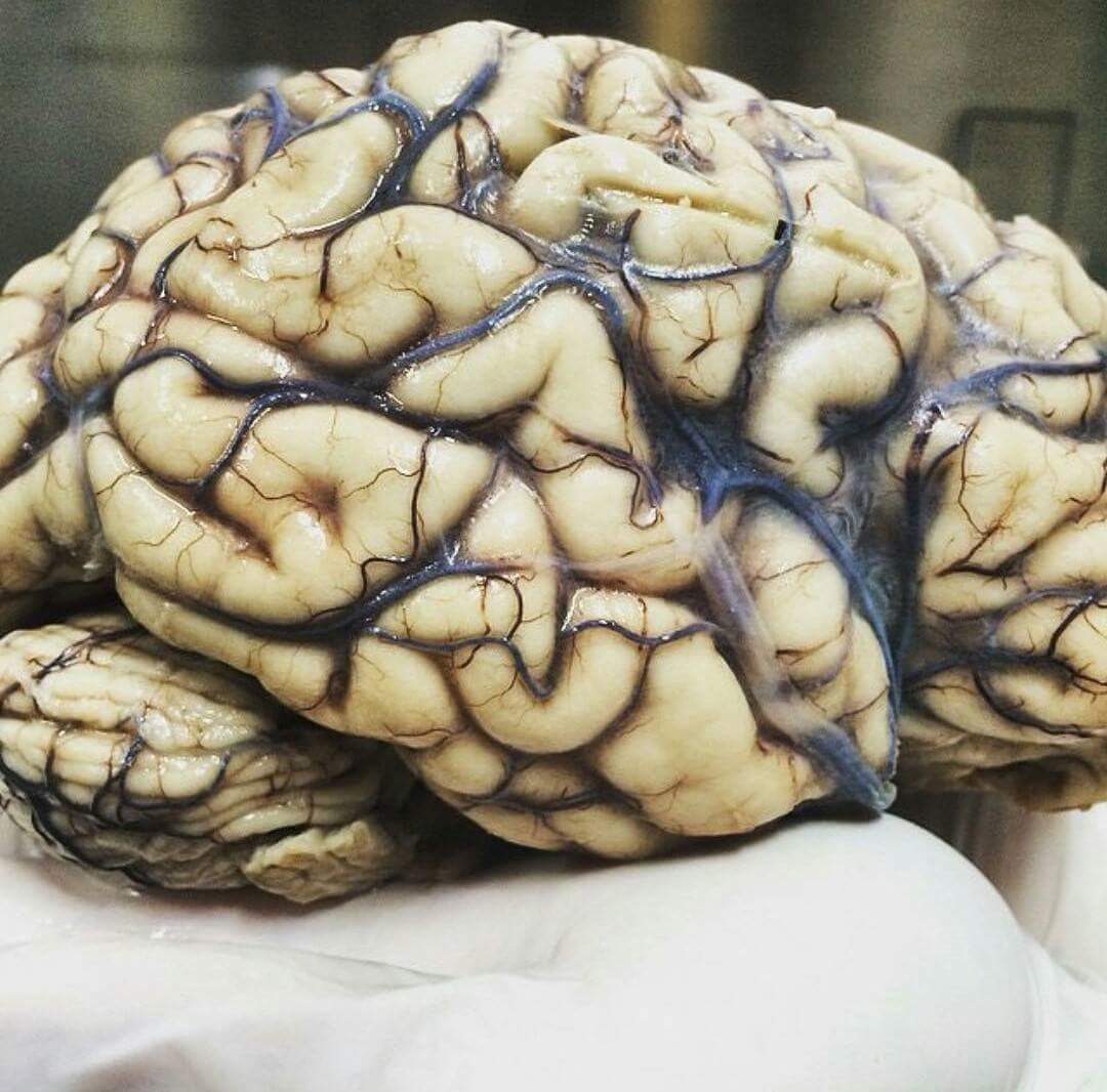 MedicinaUNR's tweet photo. #Neuro ☤❤ https://t.co/GkmMN4l9y3