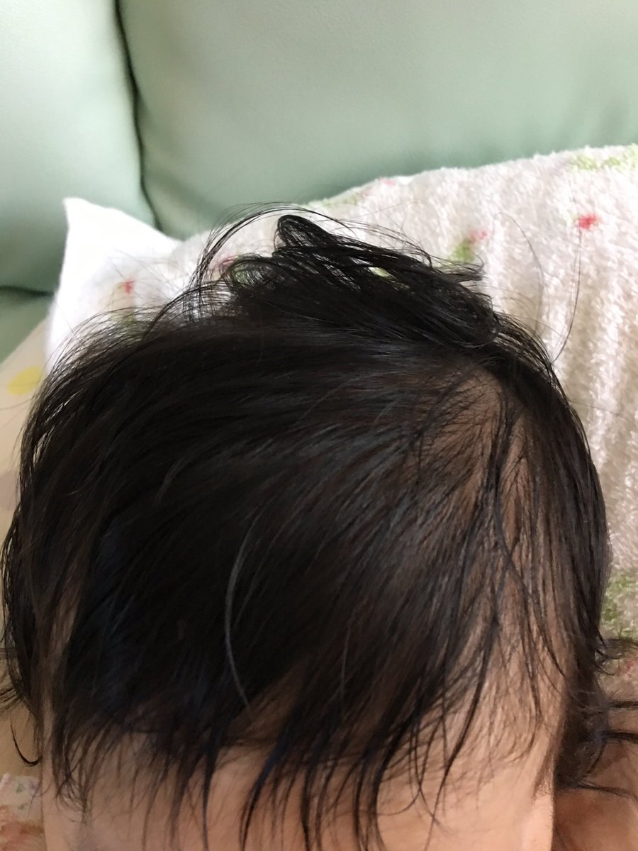 たのりゅ Twitterissa えなちゃんはツムジが2つあるせいでソフトクリームみたいな髪型になります でもそれがかわゆす そして生まれた時から 髪が多いw たのりゅ Twitterissa えなちゃんはツムジが2つあるせいでソフトクリームみたいな髪型になります でもそれがかわゆす そして生まれた時から 髪が多いw