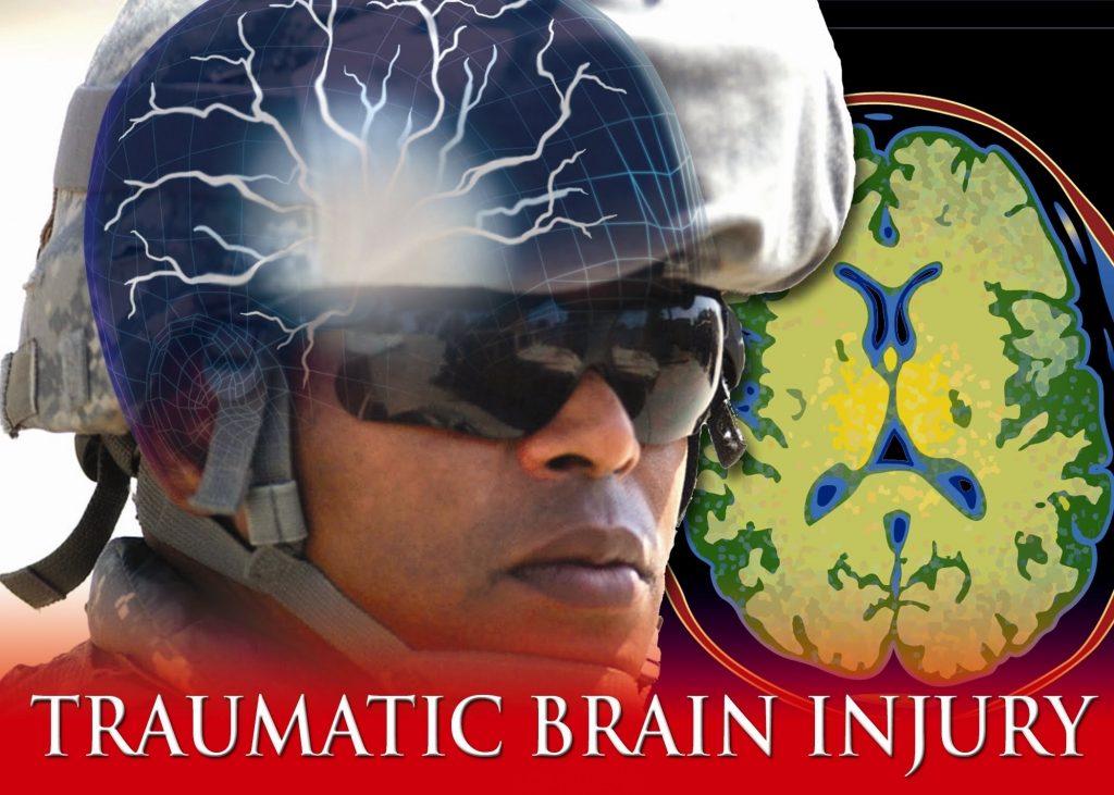 TubeFear's tweet image. Traumatic Brain Injury (documentary) - feartube.com/traumatic-brai… #BrainAnatomicalStructure