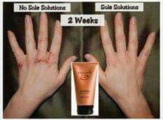 EssentialsSugar's tweet image. Sole solution is great for your hands as well as your feet ❤️