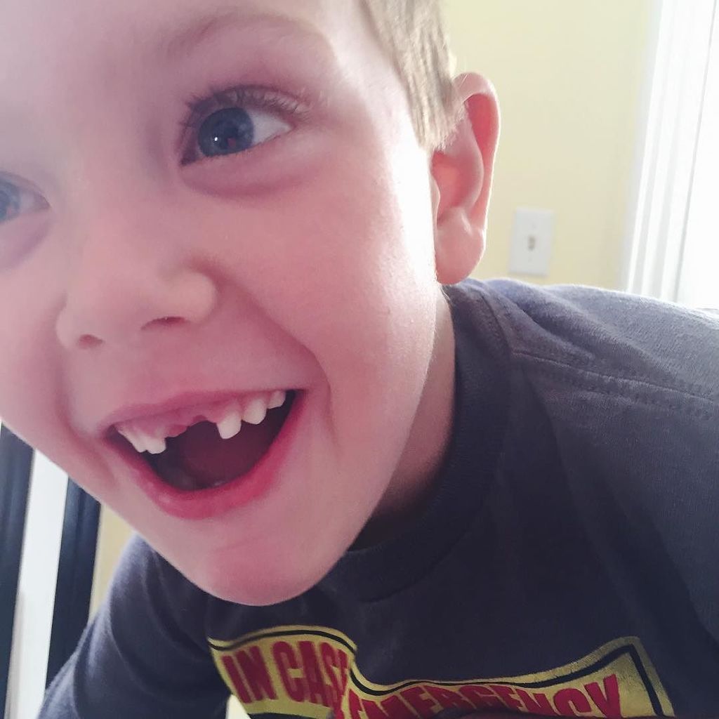 Imagn8v's tweet photo. No front teeth! #alliwantforchristmasismytwofrontteeth #goober #letthekids https://t.co/Od7KM5m2eH https://t.co/2MMZI0PFFp