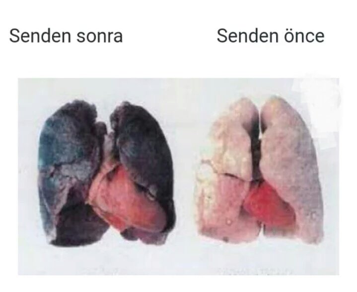 Mustafatrx's tweet photo. Ciğer bırakmadın zalimin kızı bu şekilde olmayı #haketmedik 😞 https://t.co/ZqhjrrBmHW