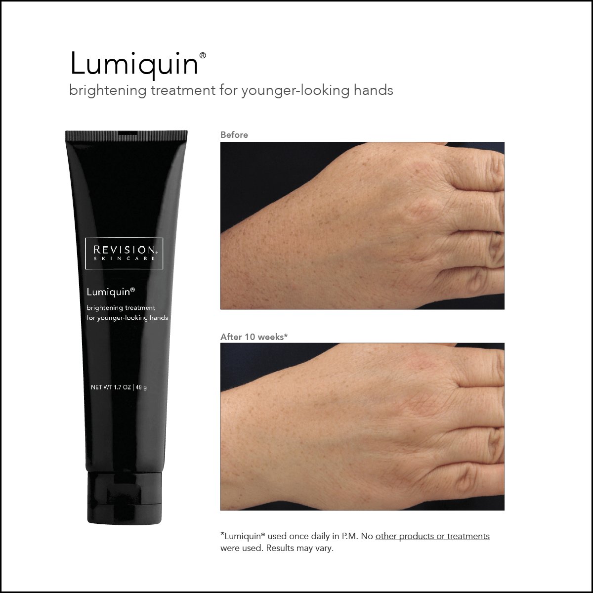 RevisionSkin's tweet photo. More about #Lumiquin: “Should I apply this product all over my hands?” https://t.co/USq3USTlHp #RevisionSkinCareFAQs https://t.co/2ta7424Jb1