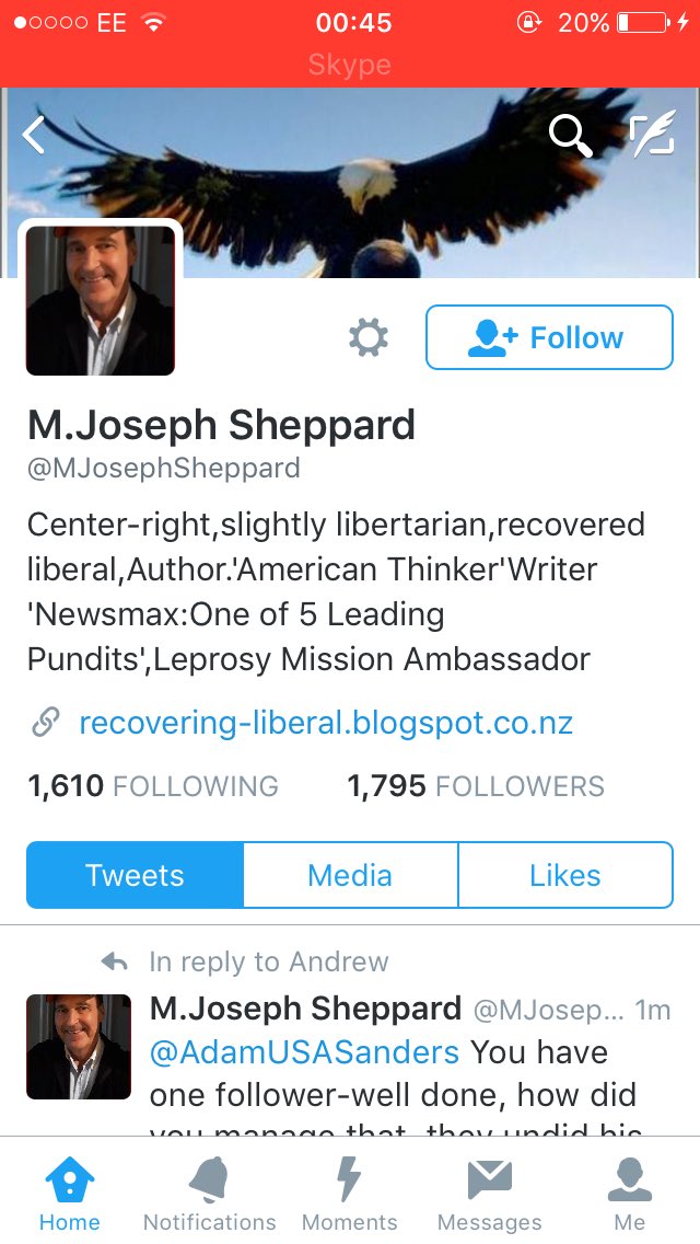 AdamUSASanders's tweet image. @MJosephSheppard dude you've got leprosy