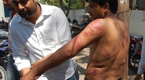 INarendra7's tweet image. BJP के संगीत सोम के पिता ने दलित ठेकेदार को पीटा, खींचे नाखून. पटरी पर फेंका. परिवार को धमकी timesmedia24.com/hindi/bjp-mla-…