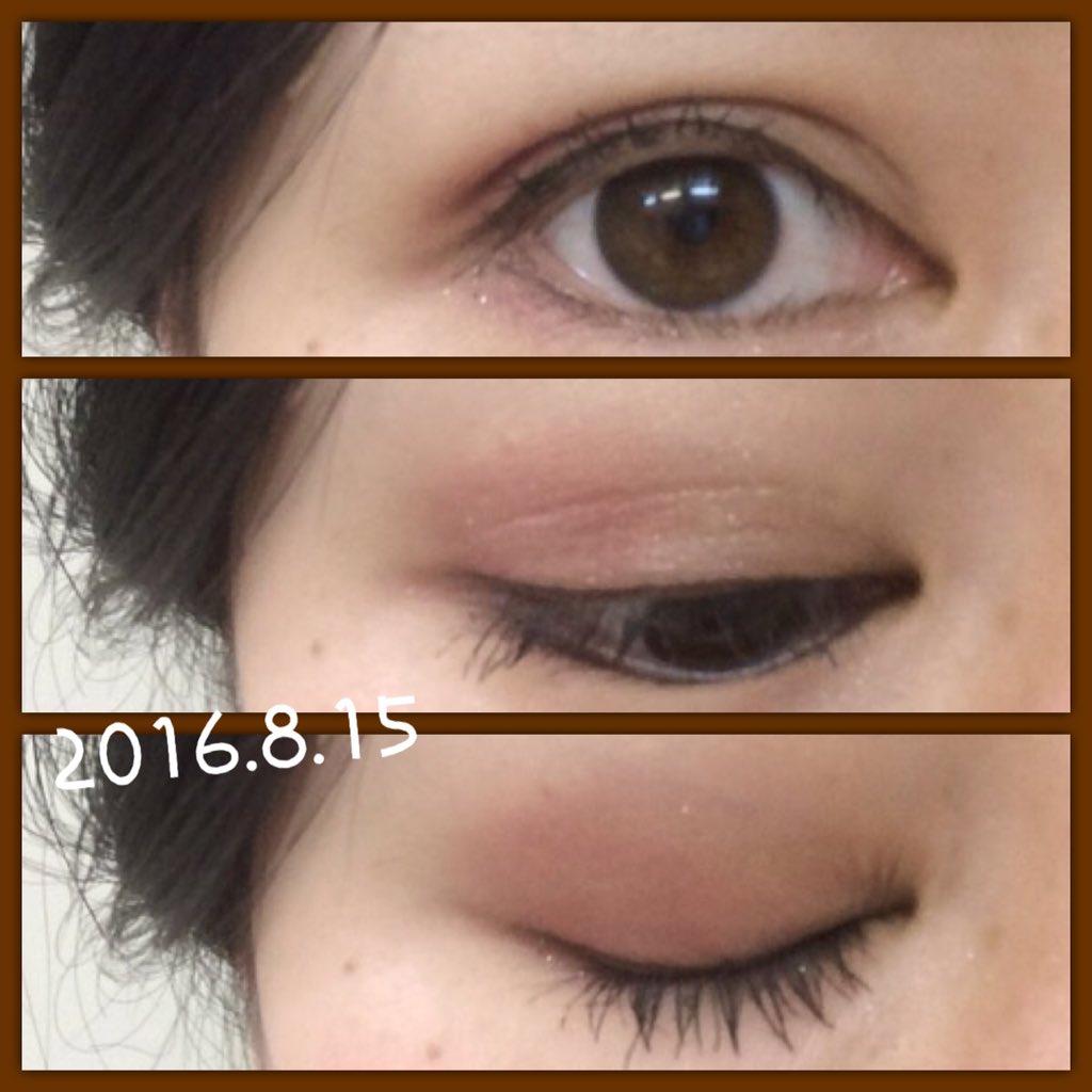 した まぶた 赤い