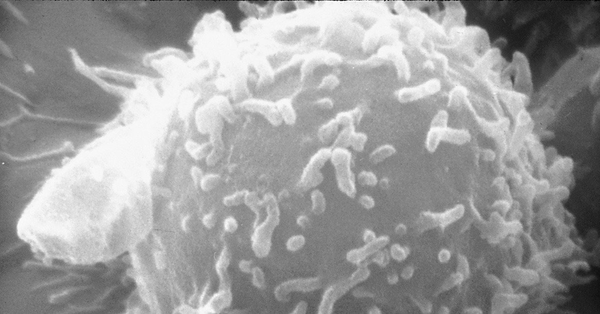 AACR's tweet photo. On the blog: Why does #immunotherapy not benefit everyone long-term? https://t.co/wtE9xyRQ8L https://t.co/WEfCxbTqwf