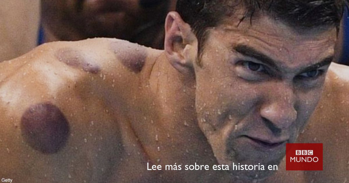 bbcmundo's tweet photo. ¿Qué son los círculos rojos en la piel de Michael Phelps y otros atletas? https://t.co/RXpi8BKIYJ @BBCDeportes https://t.co/r7gsGtgMzp