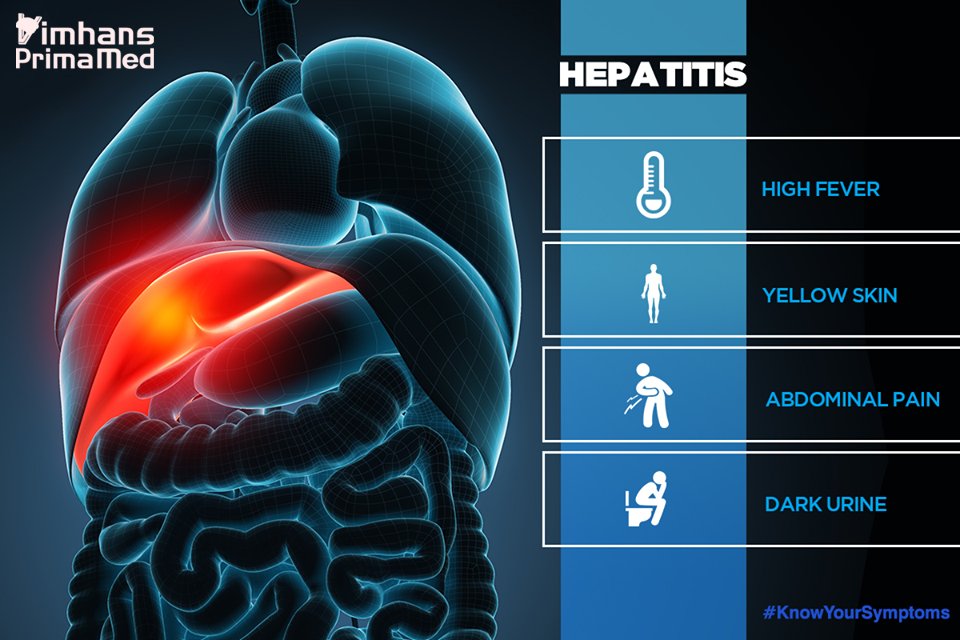 Hepatitis a symptoms