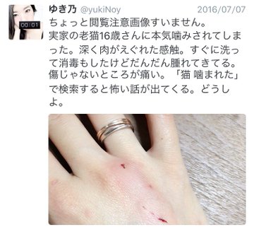 猫の 本気噛み で感染 パスツレラ症の体験談が怖すぎる エキサイトニュース