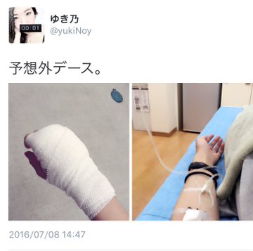 猫の 本気噛み で感染 パスツレラ症の体験談が怖すぎる エキサイトニュース