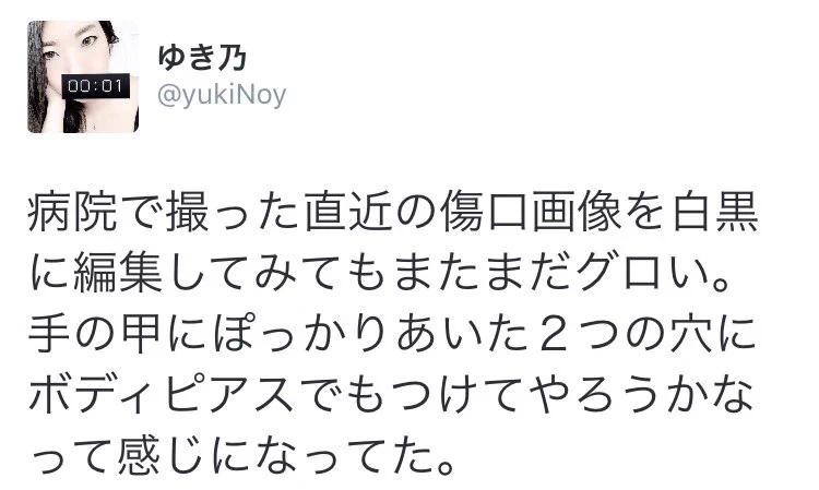 実家の老猫ちゃんに本気で噛まれた結果ｗ切開手術して完治まで３週間の大参事にｗｗｗ