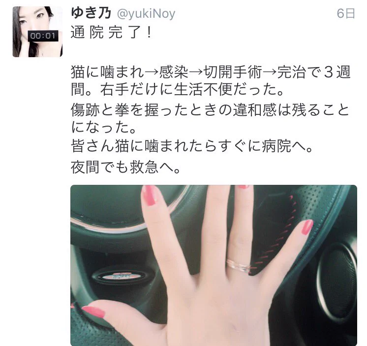 実家の老猫ちゃんに本気で噛まれた結果ｗ切開手術して完治まで３週間の大参事にｗｗｗ