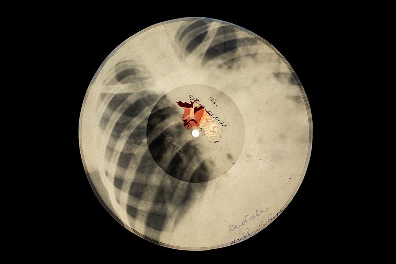 bootlegged music pressed onto x-rays in Soviet Russia → dazeddigital.com/music/article/…