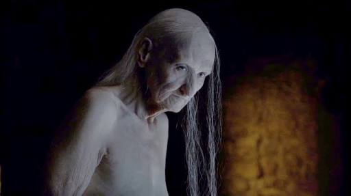 ayarrtee's tweet photo. Keira when she removes her choker #TheBachelorAu https://t.co/pGlet9hSMd