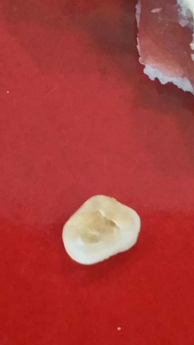 Mrtonyterry's tweet image. When did #Pillsbury start putting human teeth in #toasterstrudel ?