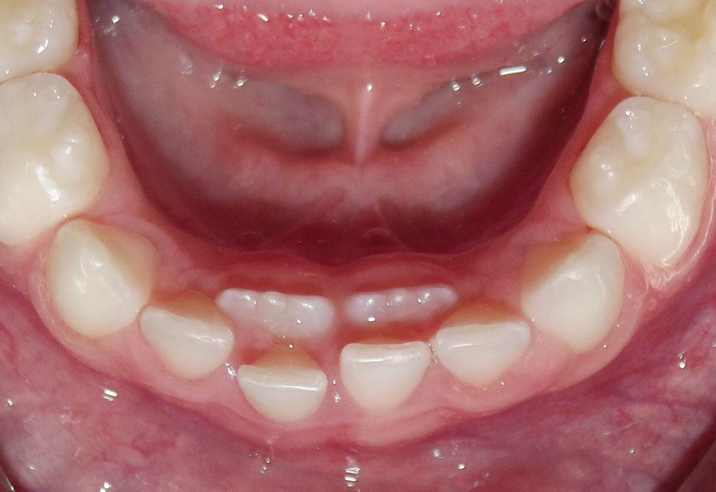 dventuredental's tweet photo. OH NO, MY CHILD IS BECOMING A SHARK!!!! https://t.co/V8mtSvlgrZ https://t.co/VDmiOElBM0