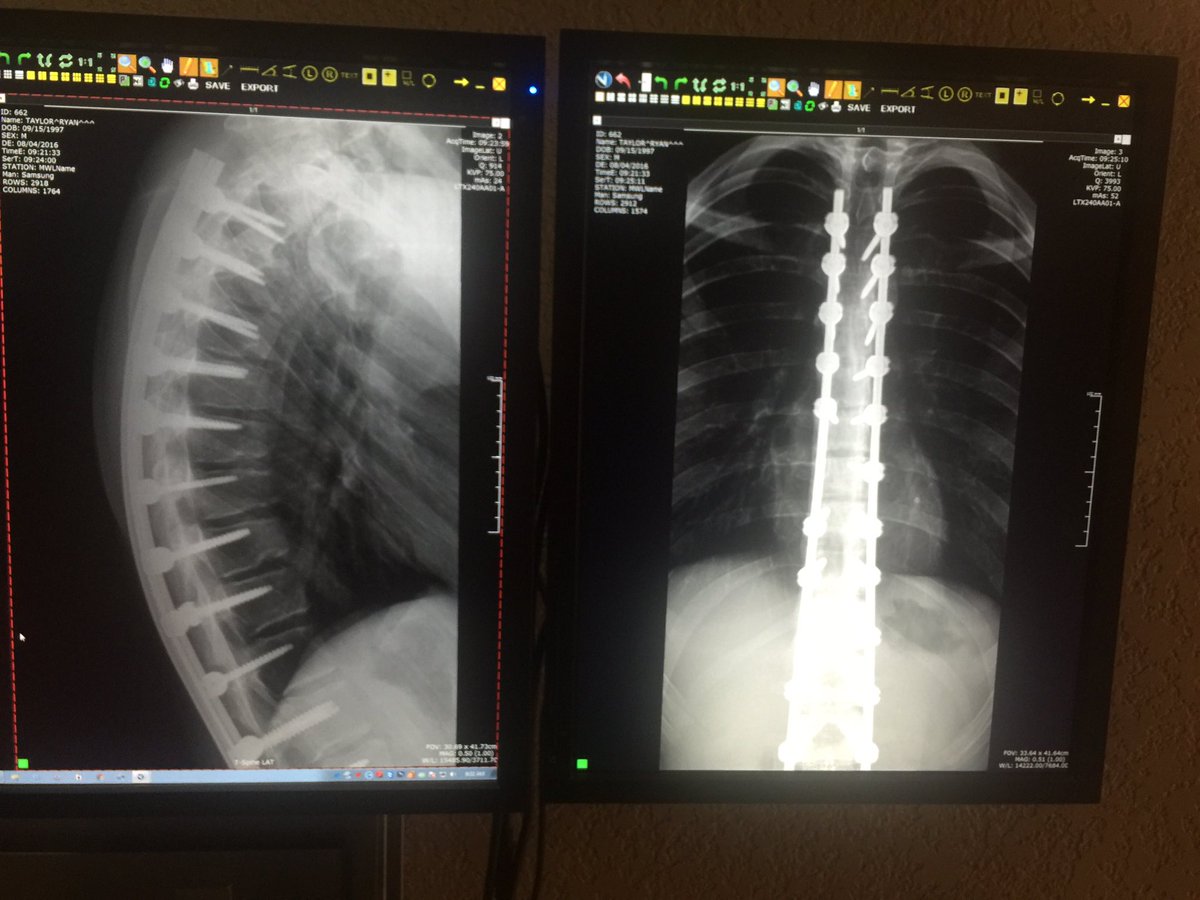 RyanRL97's tweet image. #thisismystory