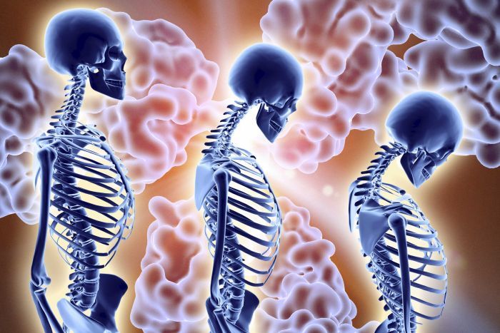 GarvanInstitute's tweet photo. Genetics behind skeletal disease: https://t.co/pkXAnFJ8Lb #HBAW #HealthyBones #Osteoporosis https://t.co/AzznLVqsmM