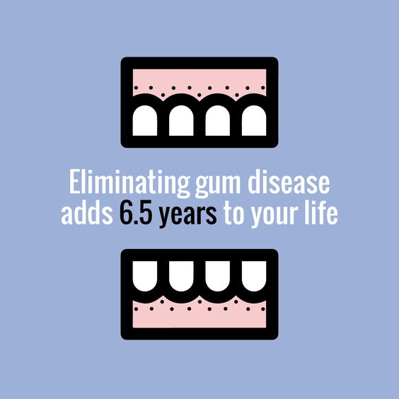 kellyenrice's tweet photo. Healthy gums are just as important as healthy teeth -- don't forget them! https://t.co/xiZuamx9JQ